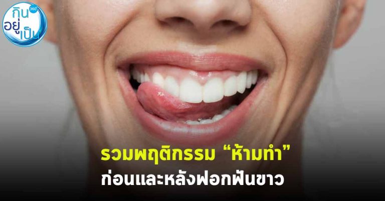 รวมพฤติกรรม “ห้ามทำ” ก่อนและหลังฟอกฟันขาว