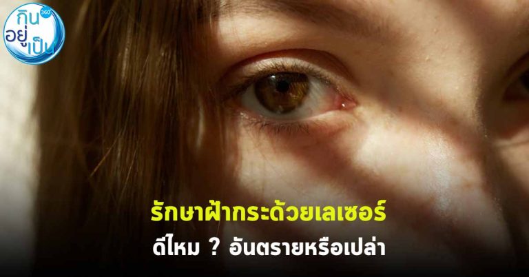 รักษาฝ้ากระด้วยเลเซอร์ ดีไหม ? อันตรายหรือเปล่า