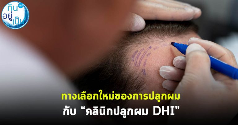 ทางเลือกใหม่ของการปลูกผม กับ “คลินิกปลูกผม DHI”